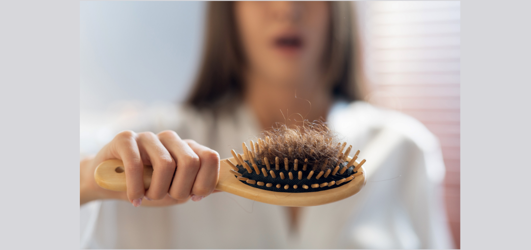 Effective Ayurvedic Treatments for Hair Fall and Dandruff: Restore Your Hair Naturally